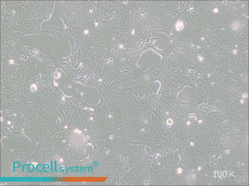 Capan-1 Cell Complete Medium - 1
