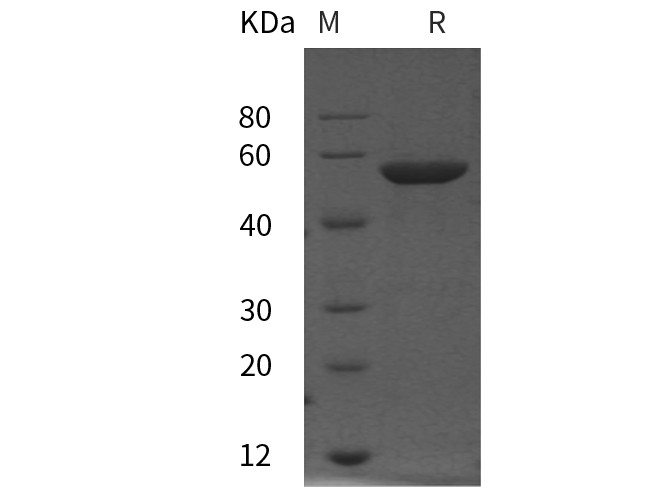Recombinant Human CD96 Protein(His Tag)-1
