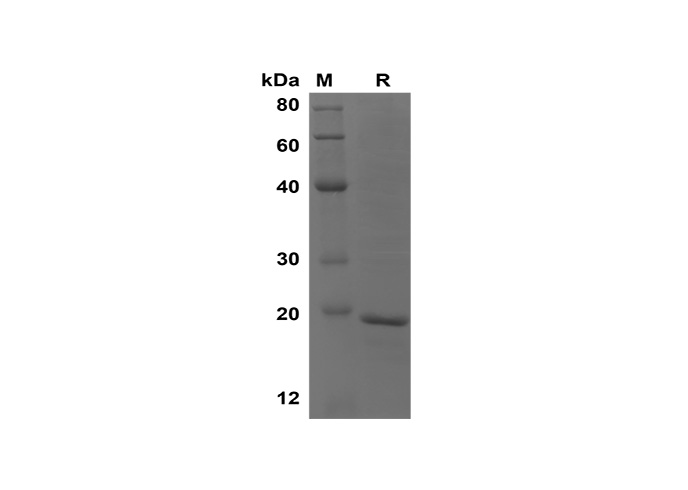 Recombinant Mouse CD4/LEU3 Protein(His Tag)-产品推荐-1