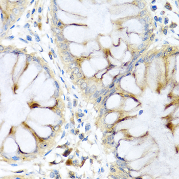 Immunohistochemistry of paraffin-embedded Human colon using PI3 Polyclonal Antibody at dilution of  1:100 (40x lens).