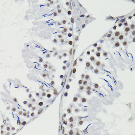 Immunohistochemistry of paraffin-embedded Rat testis using Bcl-2 Polyclonal Antibody at dilution of 1:200 (40x lens).