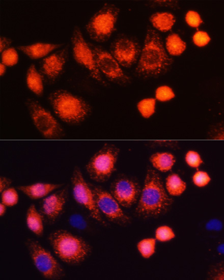 Immunofluorescence analysis of HeLa cells using HRAS Polyclonal Antibody at dilution of 1:100 (40x lens). Blue: DAPI for nuclear staining.