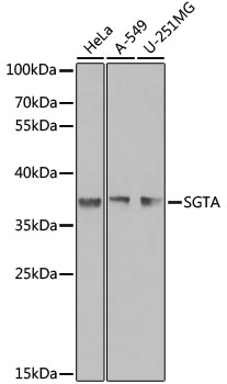 Western blot analysis of extracts of various cell lines using SGTA Polyclonal Antibody at 1:1000 dilution.