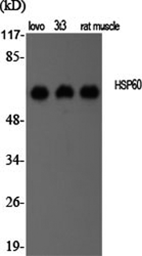 Western Blot analysis of various cells using HSP60 Polyclonal Antibody at dilution of 1:2000.