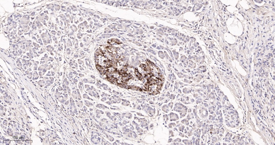 Recombinant PTEN Monoclonal Antibody - small - 3