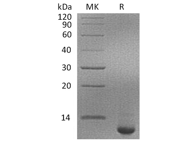 Recombinant Human SPINK4 Protein (His Tag)