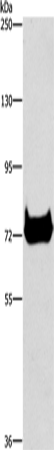 Western Blot analysis of Mouse pancreas tissue using CEL Polyclonal Antibody at dilution of 1:500