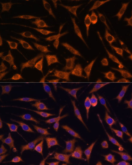 Immunofluorescence analysis of L929 cells using ACAT2 Polyclonal Antibody at dilution of  1:100. Blue: DAPI for nuclear staining.