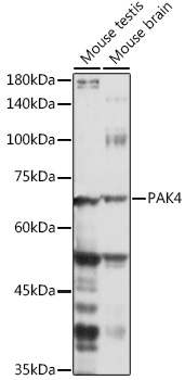 Western blot analysis of extracts of various cell lines using PAK4 Polyclonal Antibody at 1:1000 dilution.