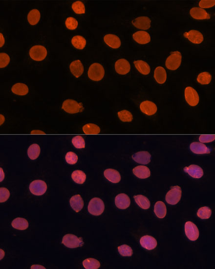 Immunofluorescence analysis of C6 cells using TADA3 Polyclonal Antibody at dilution of  1:100. Blue: DAPI for nuclear staining.