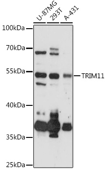 Western blot analysis of extracts of various cell lines using TRIM11 Polyclonal Antibody at 1:3000 dilution.