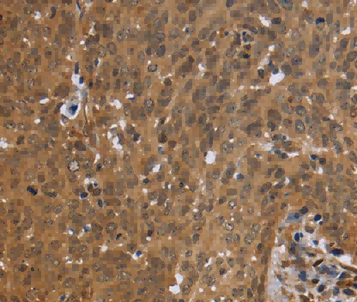 FHL2 Polyclonal Antibody - 2