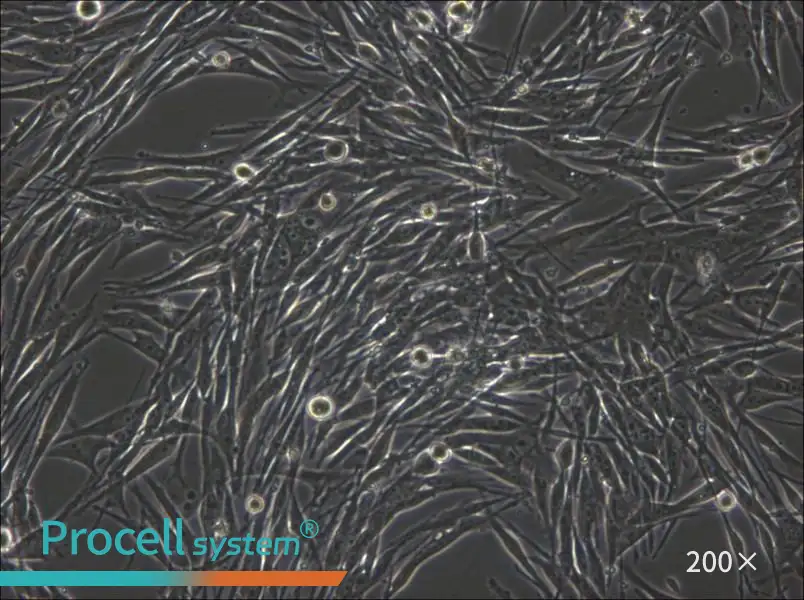 MeWo Cell Complete Medium - small - 6