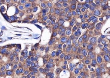 Recombinant DDX3 Monoclonal Antibody-searchlist-2