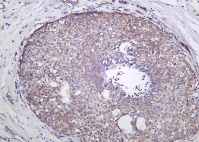 Recombinant GCN2 Monoclonal Antibody-searchlist-1
