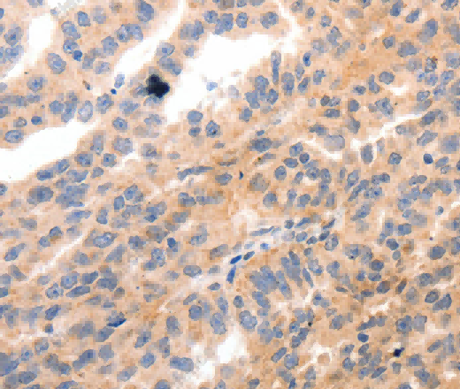 MYL9 Polyclonal Antibody - 3