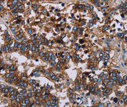 JAM-A Polyclonal Antibody - 2