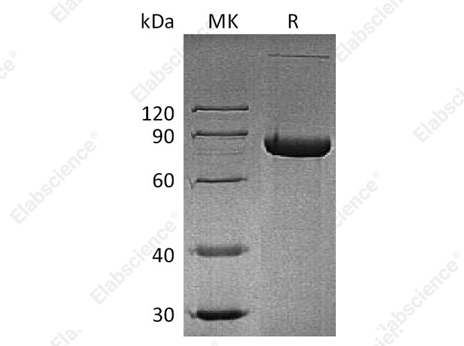 Recombinant Human CD4/LEU3 Protein (Fc Tag) - 1