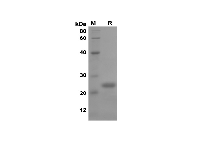 Recombinant Mouse IL-1 beta/IL1B Protein-产品推荐-4