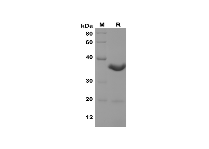 Recombinant Human CSF2 Protein-产品推荐-1