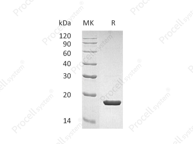 IL-1RA/ICIL-1RA/IRAP/IL-1RN, Human, Recombinant