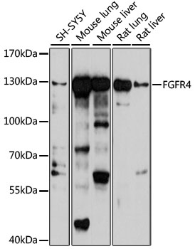 Western blot analysis of extracts of various cell lines using FGFR4 Polyclonal Antibody at 1:1000 dilution.