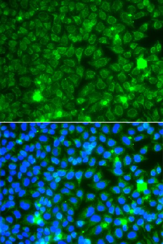 Immunofluorescence analysis of A549 cells using GBA3 Polyclonal Antibody