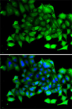 Immunofluorescence analysis of A-549 cells using CLIC4 Polyclonal Antibody