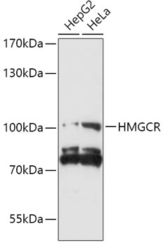 Western blot analysis of extracts from normal (control) and HMGCR knockout (KO) 293T cells, using HMGCR Polyclonal Antibody at 1:1000 dilution.