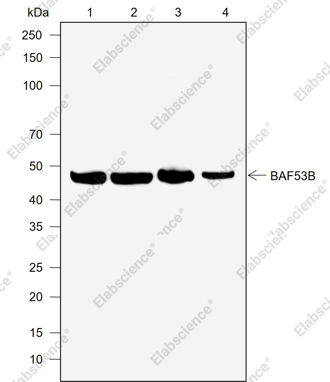 Recombinant BAF53B Monoclonal Antibody - 1