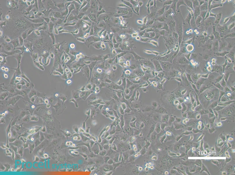 Anglne - 1