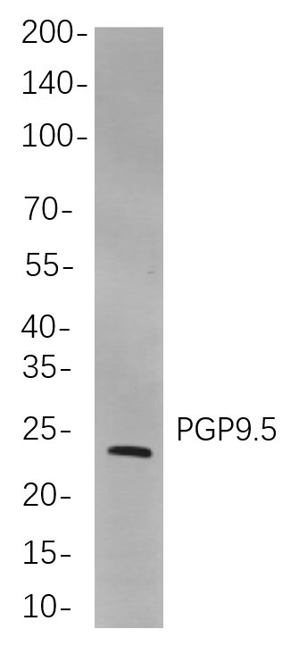 Recombinant PGP9.5 Monoclonal Antibody-searchlist-1