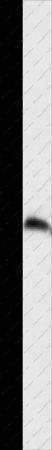 FGF12 Polyclonal Antibody - 1