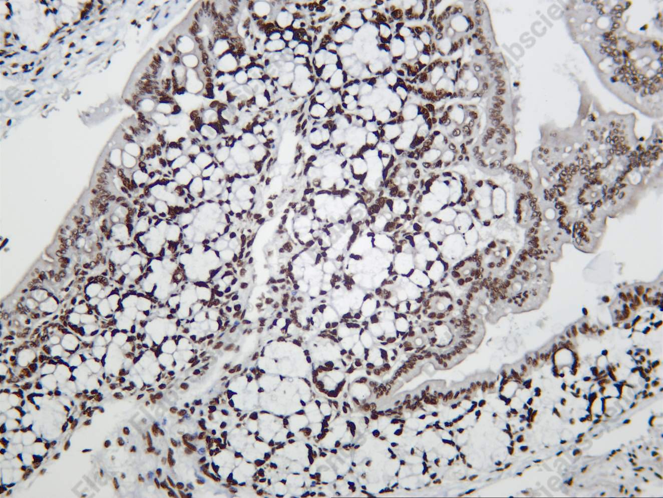 Recombinant Histone H4 (Acetyl Lys12) Monoclonal Antibody - 3