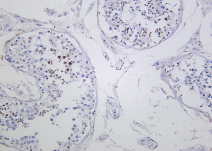 Recombinant Phospho-Histone H3 (Ser10, Thr11) Monoclonal Antibody - small - 2