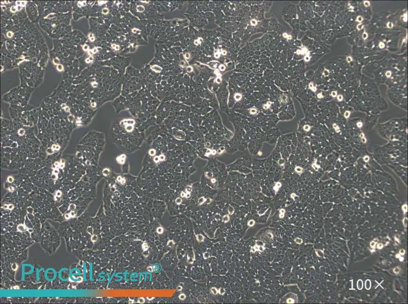 WSU-HN30 Cell Complete Medium - 3