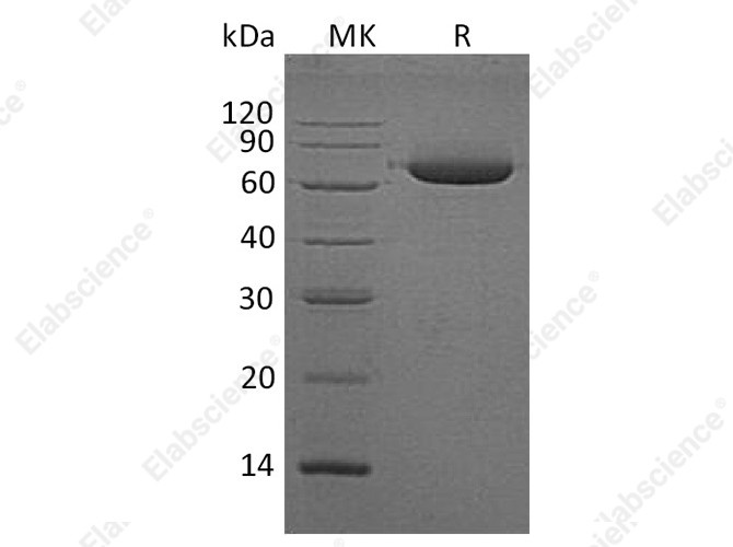 Recombinant Human Alkaline Phosphatase/ALPL Protein (His Tag) - 1