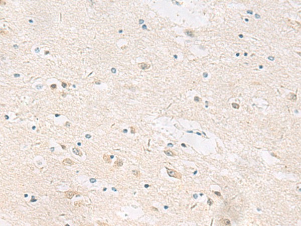 Immunohistochemistry of paraffin-embedded Human brain tissue  using ANKS6 Polyclonal Antibody at dilution of 1:55(?200)