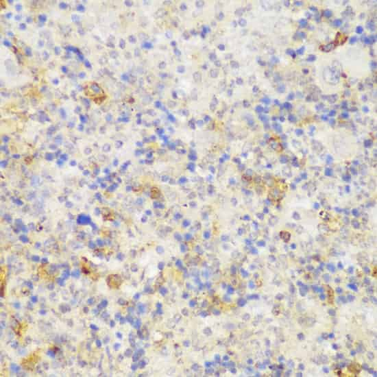 Immunohistochemistry of paraffin-embedded Mouse spleen using GCC2 Polyclonal Antibody at dilution of  1:150 (40x lens).