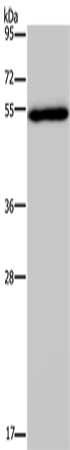 Western Blot analysis of Human breast infiltRative duct tissue using FOXC2 Polyclonal Antibody at dilution of 1:833