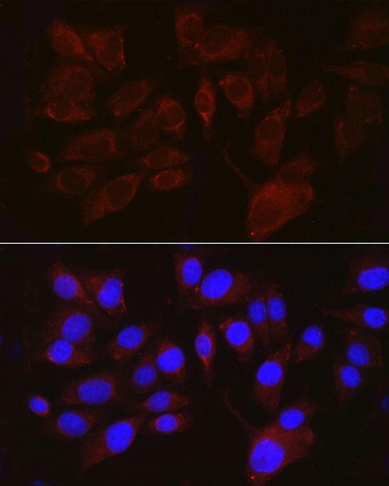 Immunofluorescence analysis of A375 cells using PMEL Polyclonal Antibody at dilution of 1:100 (40x lens). Blue: DAPI for nuclear staining.