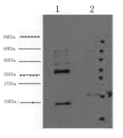 Western Blot analysis of 1) Hela, 2) 293T cells using CA9 Monoclonal Antibody at dilution of 1:5000.