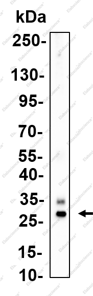 Recombinant Myelin Protein Zero Monoclonal Antibody - 3