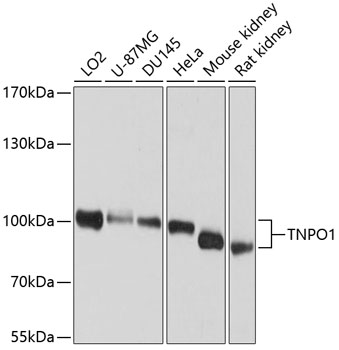 Western blot analysis of extracts of various cell lines using TNPO1 Polyclonal Antibody at dilution of 1:1000.