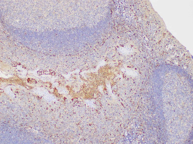 Immunohistochemistry of paraffin-embedded Human tonsil using S100A4 Polycloanl Antibody at dilution of 1:200