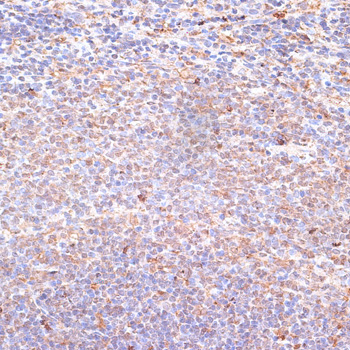 Immunohistochemistry of paraffin-embedded Rat spleen using NFE2L1 Polyclonal Antibody at dilution of 1:100 (40x lens).