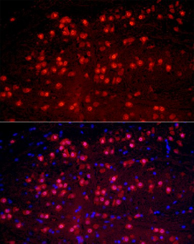 Immunofluorescence analysis of mouse brain cells using RBFOX1 Polyclonal Antibody at dilution of 1:50 (40x lens). Blue: DAPI for nuclear staining.