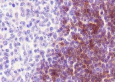 Recombinant CD1c Monoclonal Antibody-searchlist-2