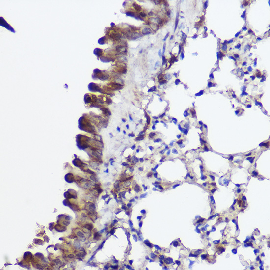 Immunohistochemistry of paraffin-embedded mouse lung using ABCA8A Polyclonal Antibody at dilution of 1:100 (40x lens).Perform high pressure antigen retrieval with 10 mM citrate buffer pH 6.0 before commencing with IHC staining protocol.