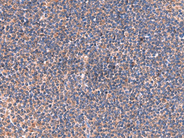 Immunohistochemistry of paraffin-embedded Human tonsil tissue  using ISM1 Polyclonal Antibody at dilution of 1:40(?200)